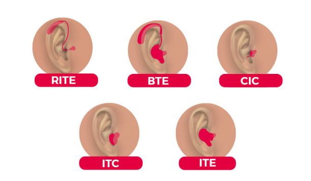 Tipos de audífonos